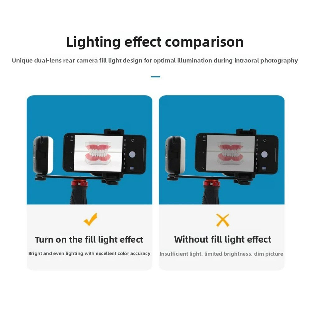 Dental Photography Light, Blue - đánh giá và giá Photography Basics